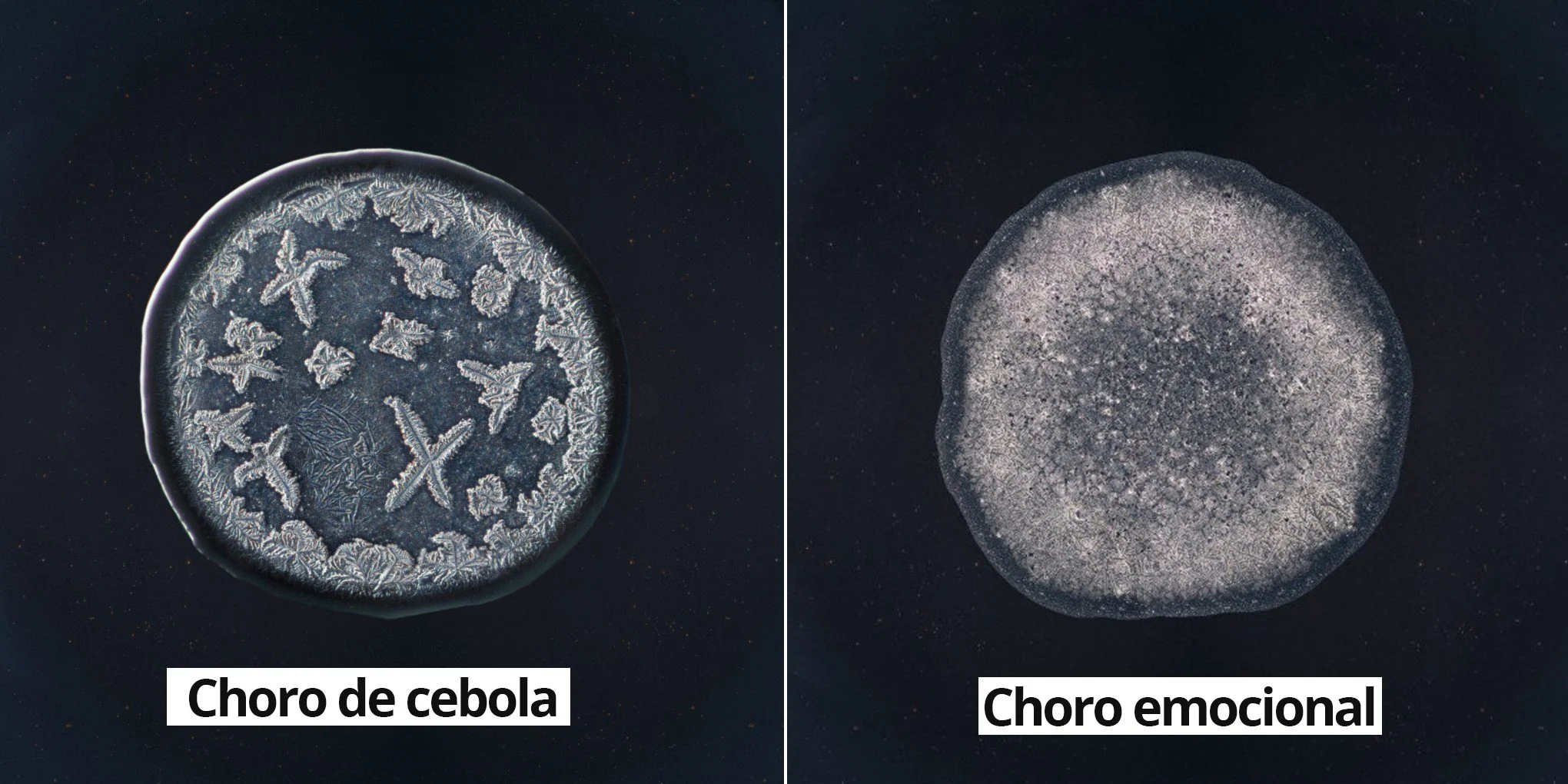 TIPOS DE LÁGRIMAS SOB UM MICROSCÓPIO